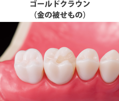 ゴールドクラウン