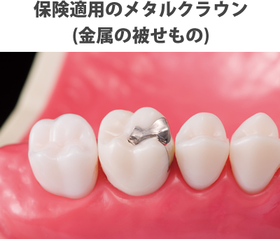 ゴールドクラウン